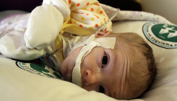 3 aylık Yağız bebek, tedavilere cevap verdi